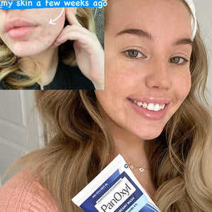 PanOxyl - Acne Creamy Wash - image 2